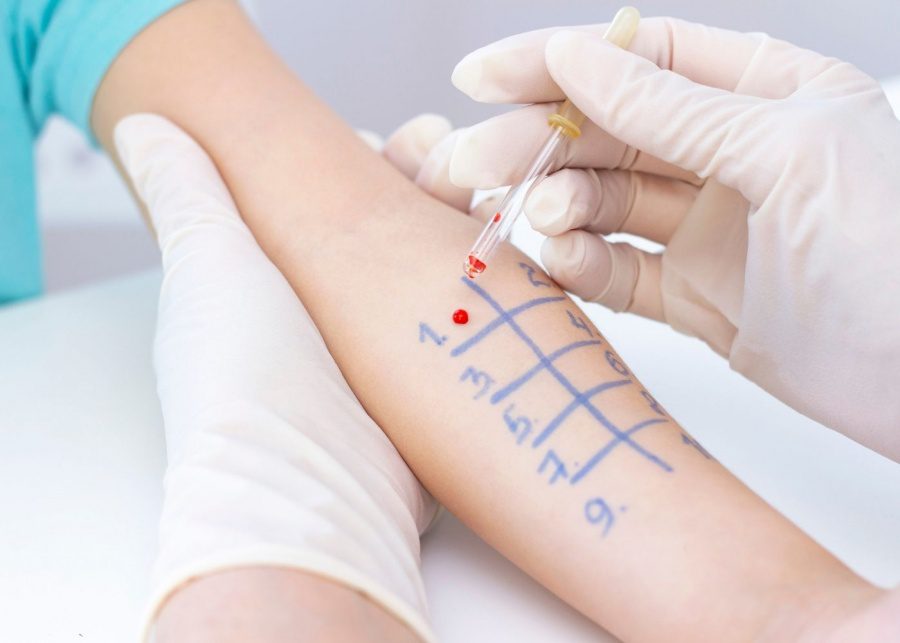 international medical clinic allergy clinic skin prick test